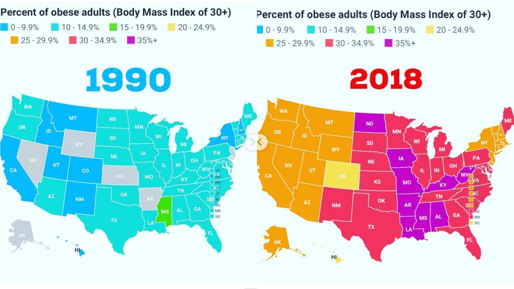 us obesity